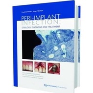 Peri-Implant Infection - Etiology, Diagnosis And Treatment