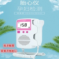 Shengtang Fetal Heart Monitor Baby Fetal Heart Fetal Heart Monitor Rechargeable Pregnancy Monitor Do
