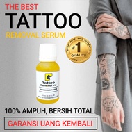 Cara Cepat Hilangkan Tato - Tattoo Removal Inc