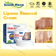 50G Lipoma Removal Cream Lipolysis Fat Lump Relief Plaster Anti-Tumor Skin Swelling Pain Ointment Re