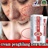 Whitening Freckle Cream 20g Penghilangkan Bintik Gelap Anti Bintik Niacinamide Memudar Pigmentasi Me