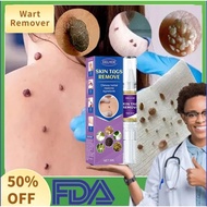 （New）Wart Removal Warts Remover Original Cream Wart Removal Liquid Pen Hand Foot Warts Remove Filifo