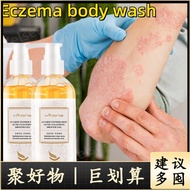 sabun gatal kulit eczema eczema body wash eczema treatment Gatal Kulit treatment eczema psoriasis Ri