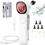 Digital Otoscope with IPS Screen, 720p HD Smart Visual Ear Camera, Ear Scope Otoscope Camera , Ear W