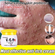 Eczema Cream Psoriasis Cream Itchy Skin Cream Anti Fungal Itch Relief Antibacterial Dermatitis Herba