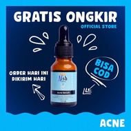 XK525 Aish Serum Acne Aish Serum Korea Ais Acne Serum Aish Serum Origi