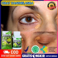Obat xanthelasma Penghilang plak kuning di sudut mata Obat mata Xanthelasma Cara mengobati Xanthelas