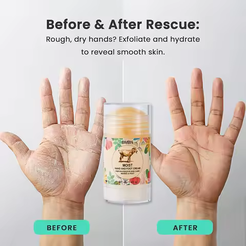 Hand And Foot Care Stick Lanolin Hyaluronic Acid Moisturizing Cream, Hydrating Nourishing Balm For D