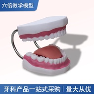 6Six Times Magnification Dental Model Teaching Brushing Tongue Fixed Model Kindergarten Children Den