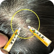 Ready Scalp Itchy Scalp Dandruff Scalp Repeated Scab Scalp Cowhide Silver Dandruff Ups Scalp White S