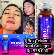 Temana Noni Peptides Collagen 1 Box (Totally Contents 10 Bottles) Collagen Skin Supplement Stretch M