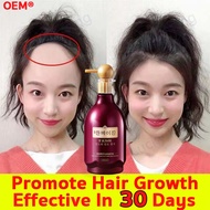 ✒100% Pure Natural pampahaba ng buhok mabilis shampoo ng kabayo pampahaba ng buhok hair grower for w