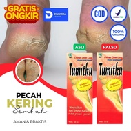 Tumitku - Salep Krim Obat Masker Kaki Pecah2 Dan Kering Parah Yg Ampuh Pembersih Penghalus Tumit Pec