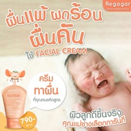 Regagar Baby Everyday Facial cream (25 Ml) For All Types Of Rashes Medical Formula Can Be Used From 
