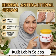 Withyoo 20g Krim krim jeragat ubat gatal herba cina krim gatal kulit herba cina ubat gatal kulit ecz
