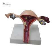 Baoblaze Uterus Reproductive Anatomy Model Study Tool Uterus Pathology Anatomy Model