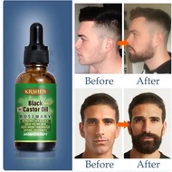 (BESTSELLER) Ginger Black Castor Oil Nourishes Hair Growth Hair Loss Essential Oil Eyebrows Growth Hair Tonic Oil for Me