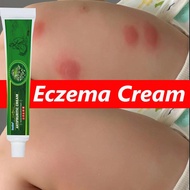 100% Effective Psoriasis Eczema Cream Original Herbal Itch Relief Antibacterial Cream Natural Anti-I