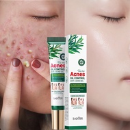 Acne Acne cream Pimple cream 20g Acne treatment gel Effective acne removal Eliminating acne scars je