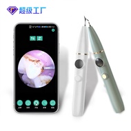 Pembersih Pergigian Ultrasonik HD Pembersih Pergigian Elektrik Visual untuk Membersihkan, Menghilang