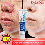 HONGKONG Dr.ledun acne removal freckle cream LION PAIR ACNE Pimple Cream 祛痘膏祛痘乳霜 18g