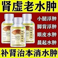 Kidney Vaginal Edema Calf Floating Edema Eyelid Instep Edema Strong Effect Edema Reduce Edema#肾阴虚水肿小