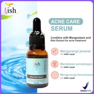 Barang Terlaris Aish Ultimate Acne - Paket Aish Beauty &amp; 1 Serum Acne