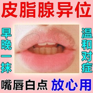 Sebaceous gland ectopic lip growth white maculopapular rash皮脂腺异位嘴唇长白斑丘疹起泡干裂脱皮唇周暗沉专用药膏早用早妤2.18