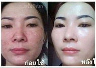 [HCM]Kem vỗ bong da mặt BEZY ThaiLan