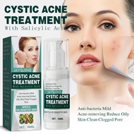 Jaysuing Salicylic acid cystic acne cream แต้มสิว ปิดปาก สิว สิว รอยสิว ครีมซ่อมแซมผิวหน้า Salicylic acid cystic acne cream 100ml