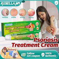 Psoriasis Eczema Treatment Cream Ointment Eczema Cream Psoriasis Cream Eczema Ubat Gatal Gatal Kulit