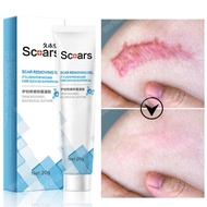 Scar REMOVER Cream SCOARS Acne SCAR Removal Cream Stretchmark/Powerful SCAR Removal Cream