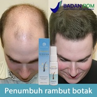 (BPOM)Serum penumbuh rambut Obat penumbuh rambut Penumbuh rambut botak