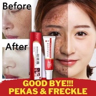 20g Melasma Cream Pekas Remover Skin Whitening Moisturizer Anti Freckle Collagen