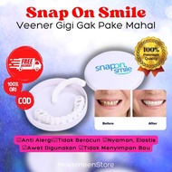 Snap On Smile Veener Gigi Palsu Instan Atas dan Bawah Gigi ORIGINAL
