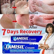 Athlete's Foot Foot Cream for German athletes (15 grams) Athlete's Foot