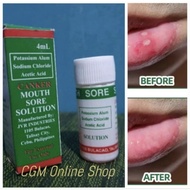 CANKER MOUTH SORE SOLUTION (Gamot sa singaw)