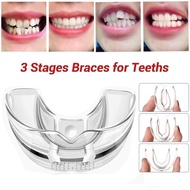Teeth Orthodontic Appliance Alignment Teeth Retainer Bruxism Mouth Guard Teeth Straightener