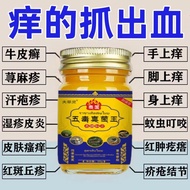 Skin Itching Cream Cowhide Silver Itching Dermatitis Blisters Dry Itching Whole Body Skin Itching Ex