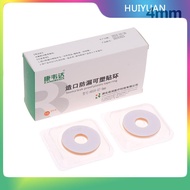 HUIYUAN 10Pc Anti-Leakage Ring For Colostomy Bag Ostomy Paste Ring Baseplates Stoma Care Products To