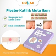 MATA Fish Eye Plaster Foot Corn Remover Fish Eye Wart And Calluses Wart Remover Plaster