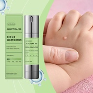 Skin Care Ointment, Soften Rough Bumpy Skin Growth on Hands & Feet