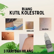 READY STOCKBUANG KUTIL KOLESTROL,BUANG TAHI LALAT,KETUAT