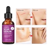 [Promosi Panas] Serum Wajah Serum Parut Esen Cecair Serum Wajah All-English Serum 3.8