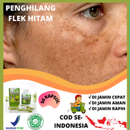 Salep Flek Hitam Penghilang Flek Salep Herbal Menghilangkan Flek Membandel Di Muka Salep Flek BPOM B