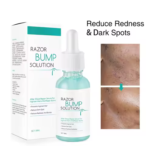 Anti-Ingrown Hair Gentle Serum 30ml Repaired Serum Redness Bumps Ingrown Hair After Shaving Prevent 