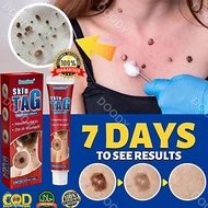 Ubat Ketuat Kutil skin tag remover ubat kutil tahi lalat ketuat dan biji kolesterol Mole Remover war