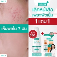 [เซ็ตสุดคุ้ม] Smooth E Sun Acne Oil Sachet & Acne Pro oil control serum เซ็ทคุมสิวซ้ำ ฟื้นผิวเรียบ ค