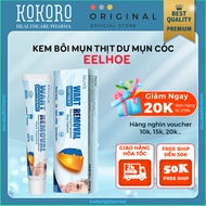 EELHOE WART REMOVAL Cream - WART REMOVAL EELHOE Skin tags, Warts, Moles Cream