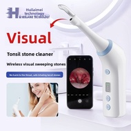 Visualized Electric Tonsil Calculus Device Oral Cleaning Care Tool Calculus Remover